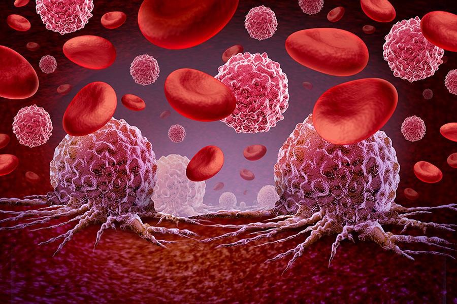 Hundreds more blood cancer patients to receive life-giving drug on NHS