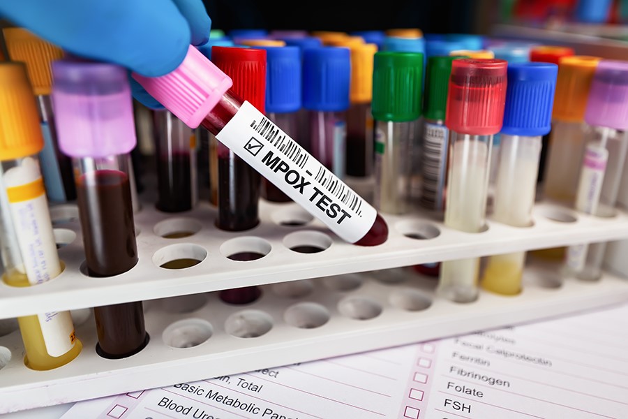 New mpox strain identified in England
