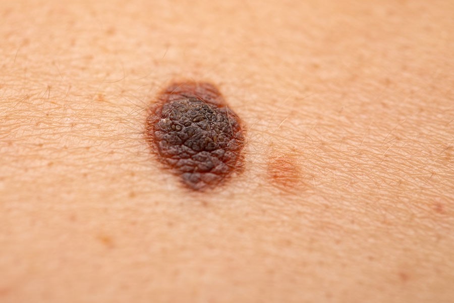 Patients benefit from digital dermatology service
