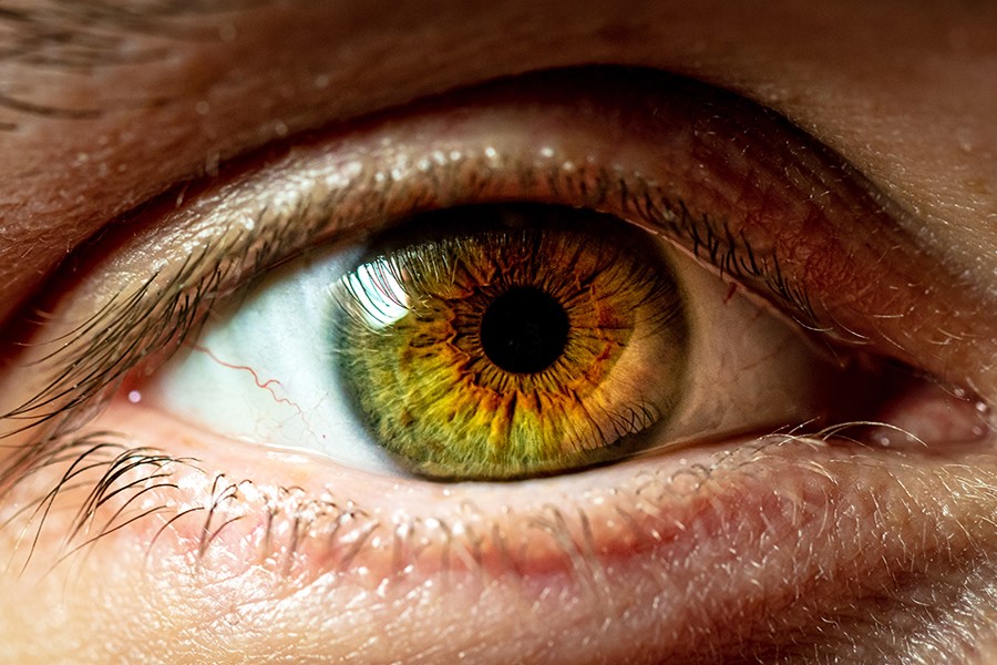 Over one million estimated to have glaucoma in UK