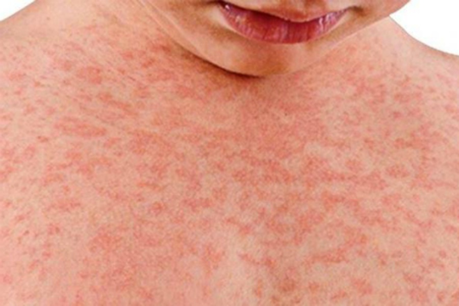 New vaccination campaign launched to boost uptake of childhood immunisations