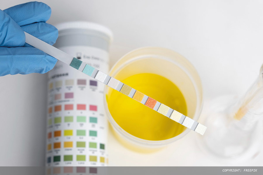 Evolution of urinalysis: from dipstick to digital solution