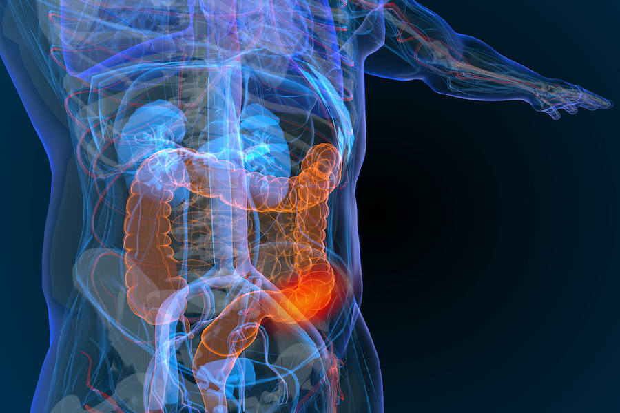 mRNA nanobodies show promise in treating colorectal cancer