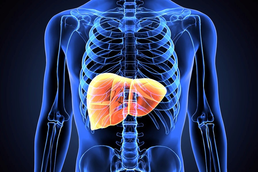Pioneering histotripsy treatment for liver cancer patients