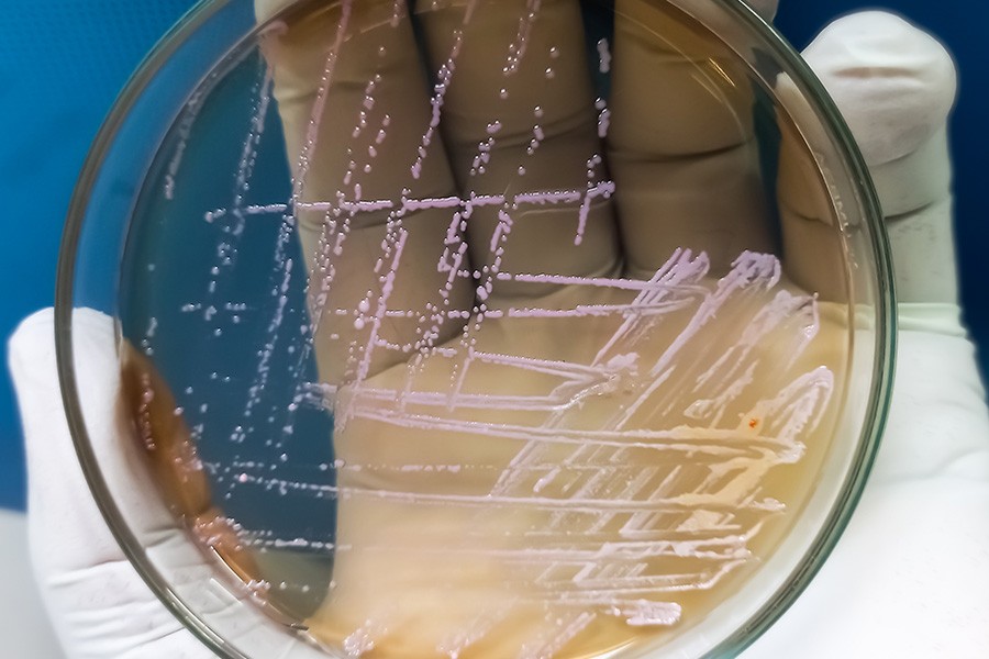 Increase in drug-resistant Shigella cases among gay and bisexual men
